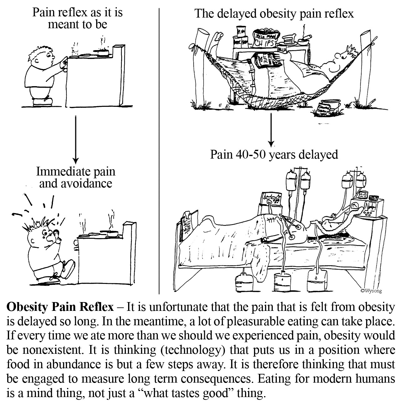 Obesity Pain Reflex